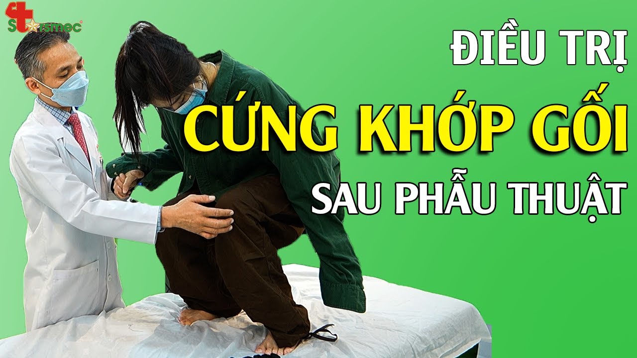 Điều trị phục hồi CỨNG KHỚP GỐI sau phẫu thuật hiệu quả | Y học Thể thao Starsmec