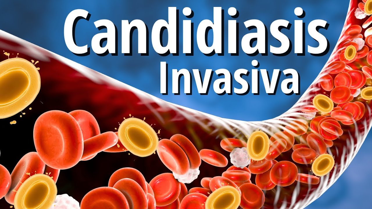 Candidiasis Invasiva Explicada Claramente