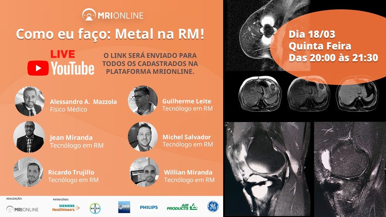 Metal na RM!
