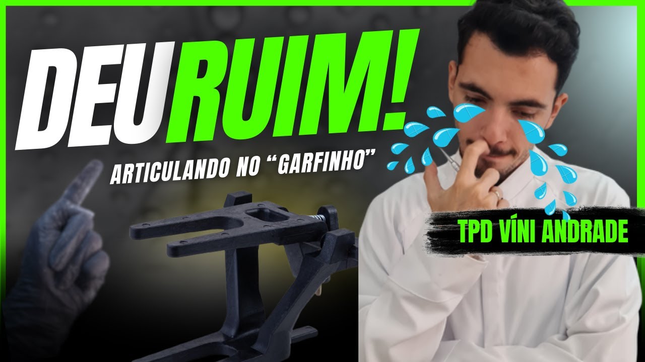 APRENDA A MONTAR UMA PRÓTESE TOTAL DUPLA NO ARTICULADOR TIPO GARFO - PASSO A PASSO.
