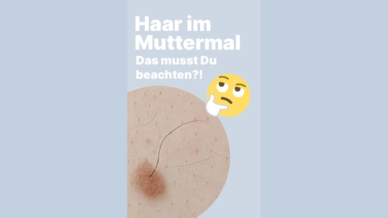 Haar im Muttermal? Das musst Du beachten!│Dr. med. Alice Martin #shorts