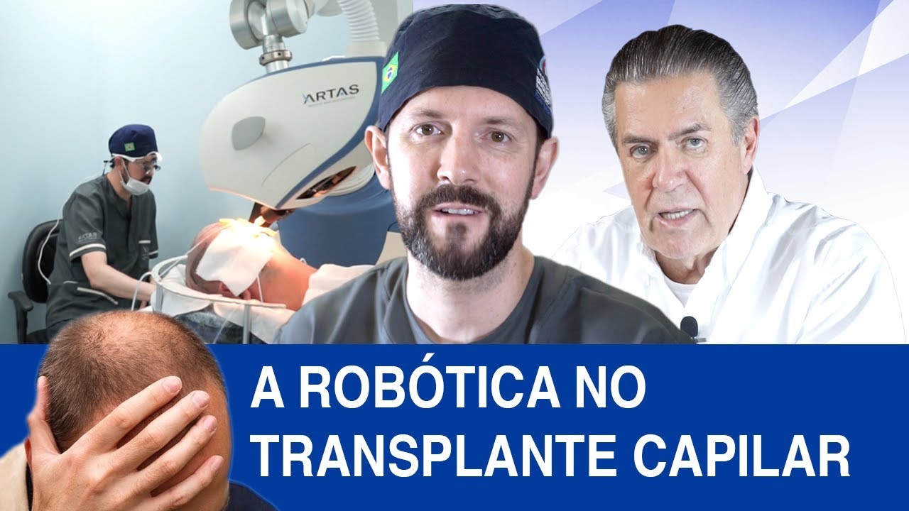 A Robótica no Transplante Capilar