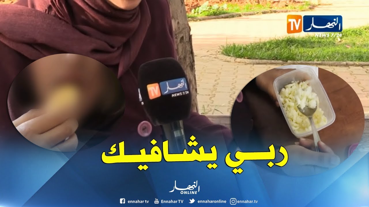 صحة: آمال ..حكاية 36 سنة من تحدي مرض السيلياك
