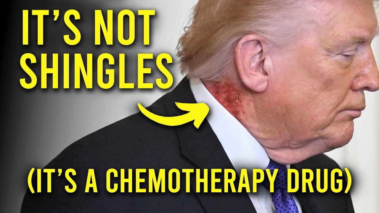 REAL DOCTOR explains Trump's NECK RASH (it's due to a chemotherapy drug?)