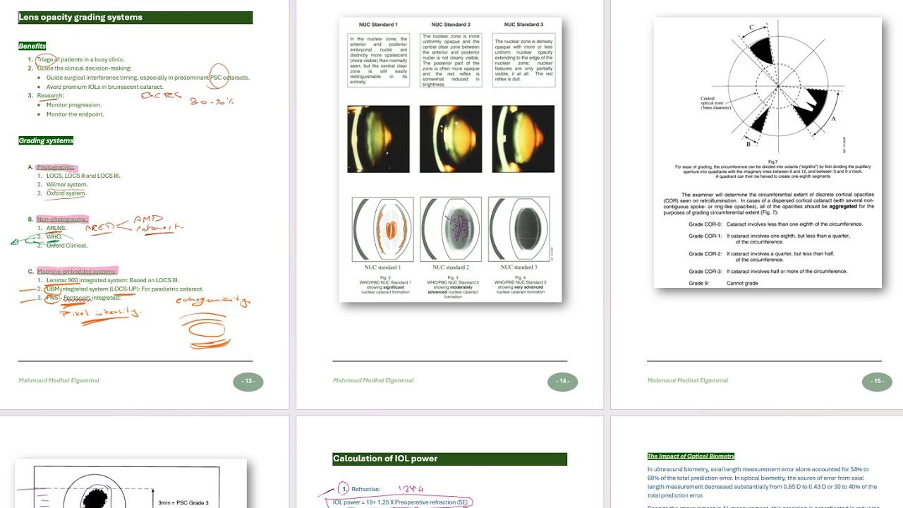 Cataract grading systems
