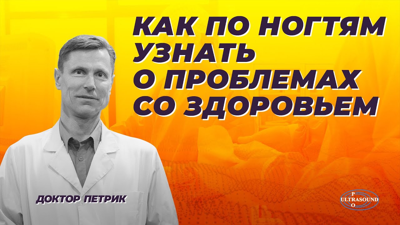 Как по ногтям узнать о проблемах со здоровьем.