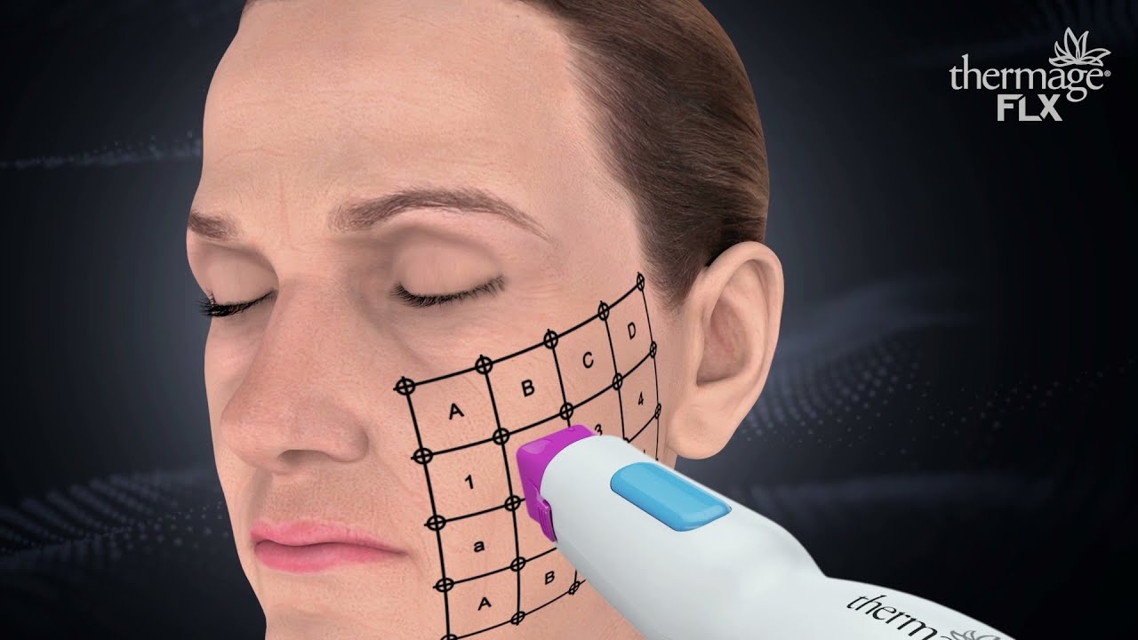 Our Thermage FLX Skin Treatments | HHC Clinics