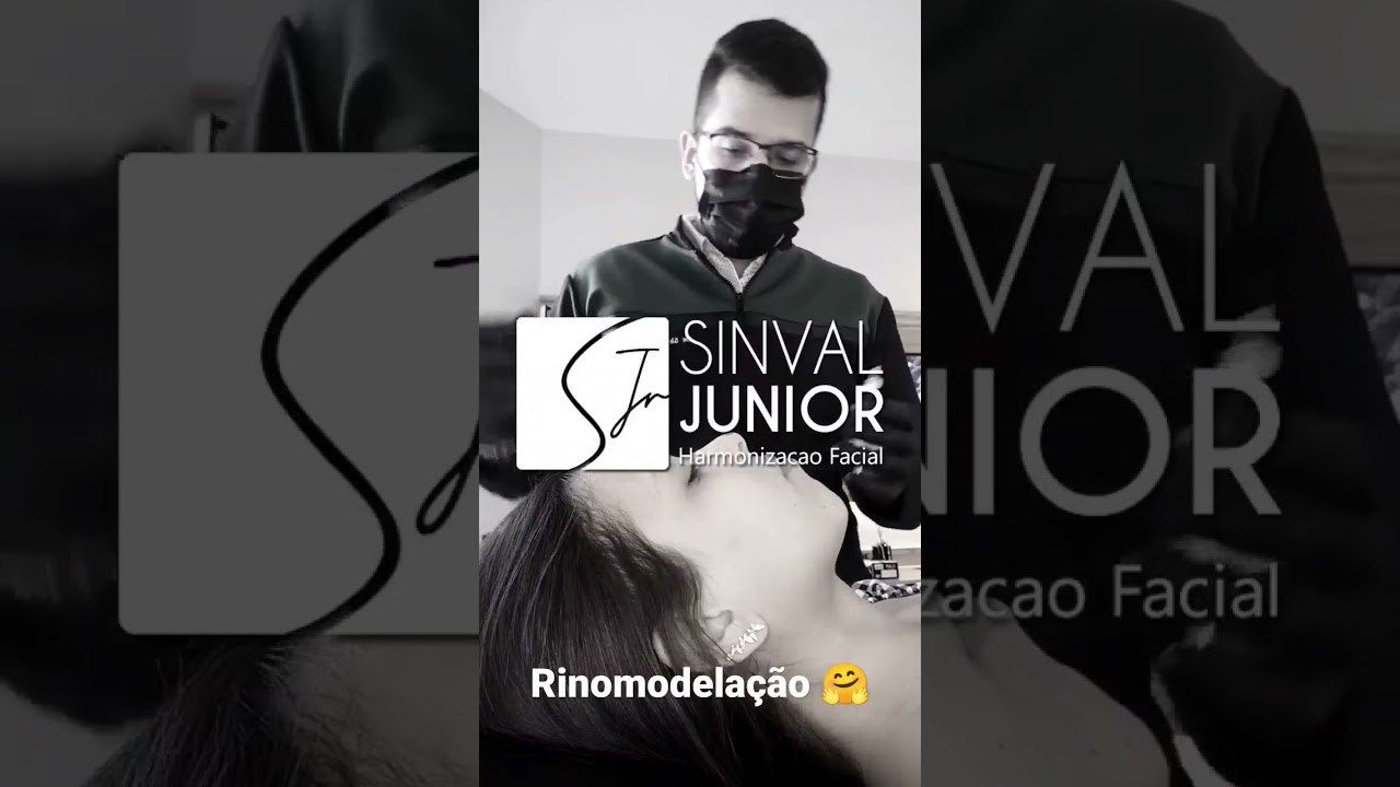 ✴️RINOMODELAÇÃO✴️ mudança no contorno do nariz com ácido hialurônico!! 