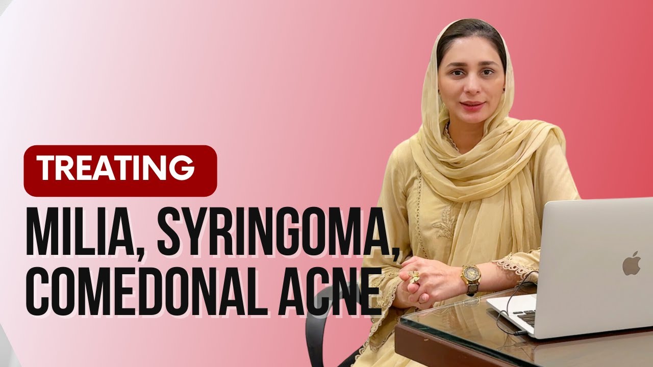 Understanding Milia, Syringomas, and Comedonal Acne: Causes & Treatment Options
