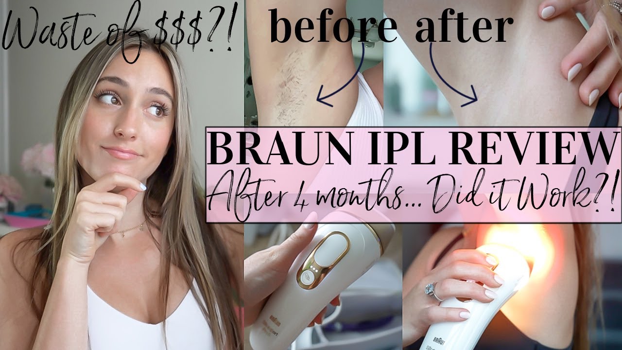 BRAUN IPL REVIEW//DID IT WORK?!//4 months later...//Hair Removal Review & Tutorial