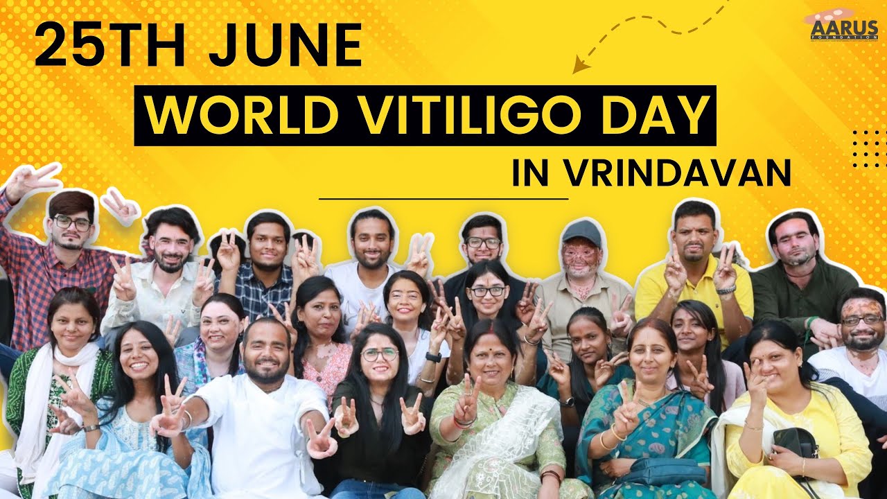 25th June 2022 World Vitiligo Day Celebration In Vrindavan | Aarus foundation | @UdtaAkash