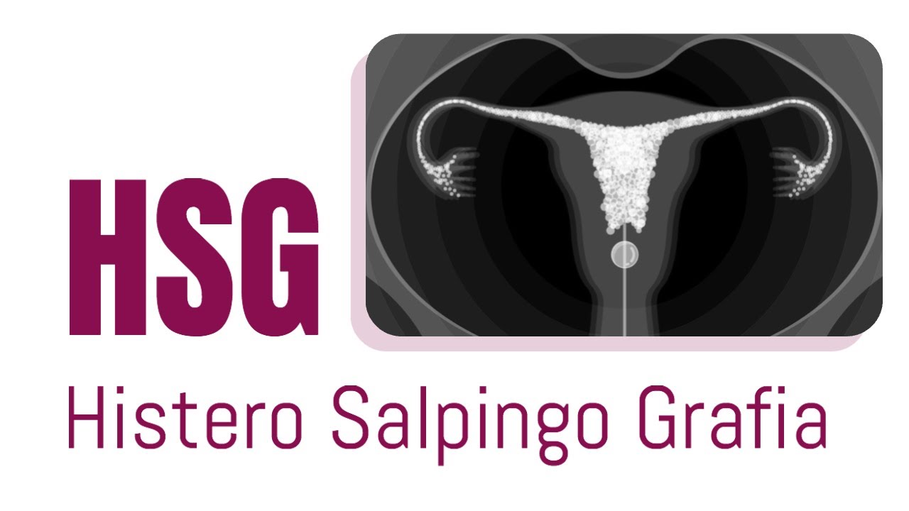HSG (Histerosalpingografia)