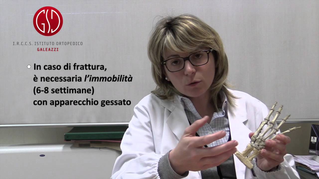 La risposta dell'Esperto &ndash; Ortopedia: frattura dello scafoide del polso