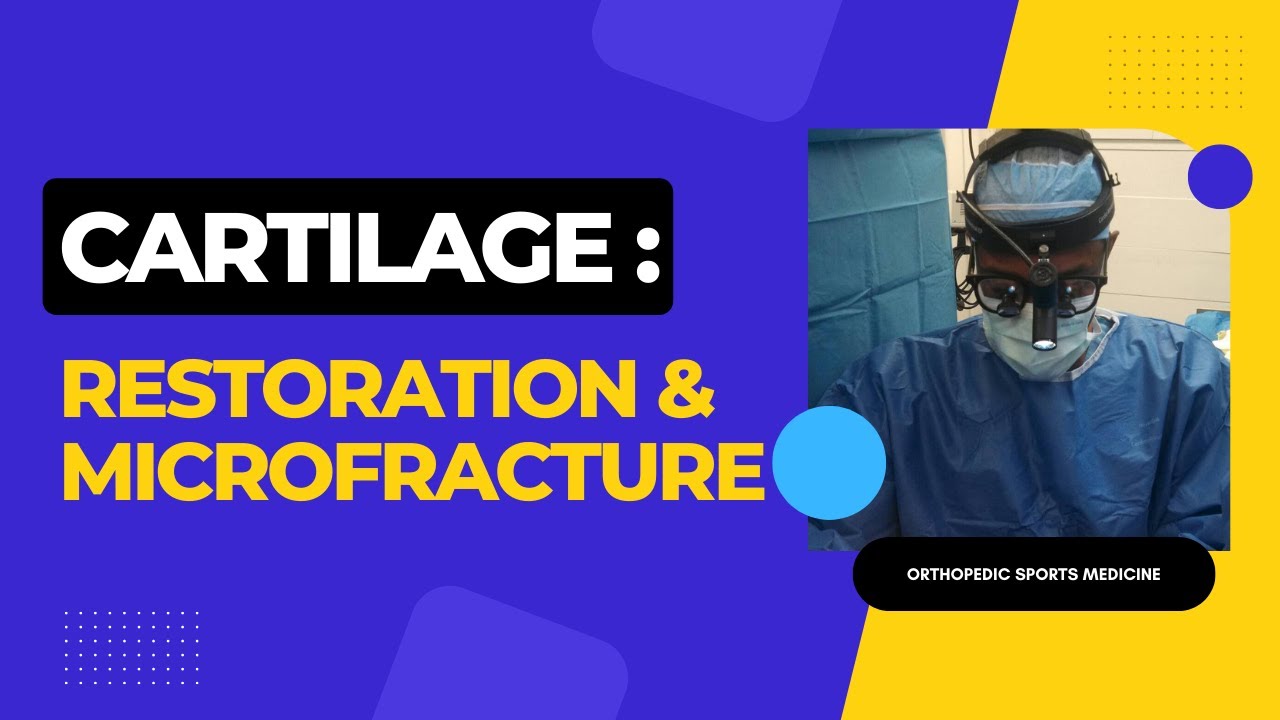 Cartilage Restoration and Microfracture in 2023