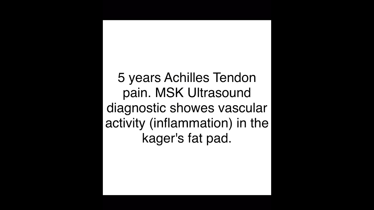 ANF treatment for Kager's fat pad inflammation