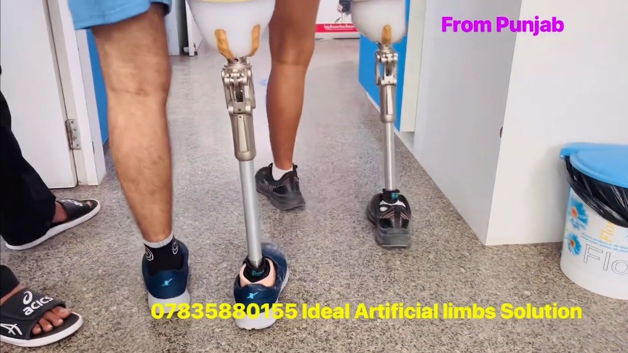 Nakli Tang l Nakli Per l Artificial Leg l best artificial limb clinic in india l OP5 knee ossur
