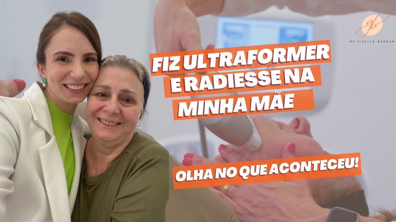 Fiz Ultraformer e Radiesse na minha Mãe olha o que aconteceu | Dra Giselle Barban
