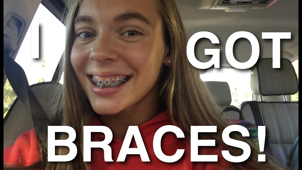 I GOT BRACES!