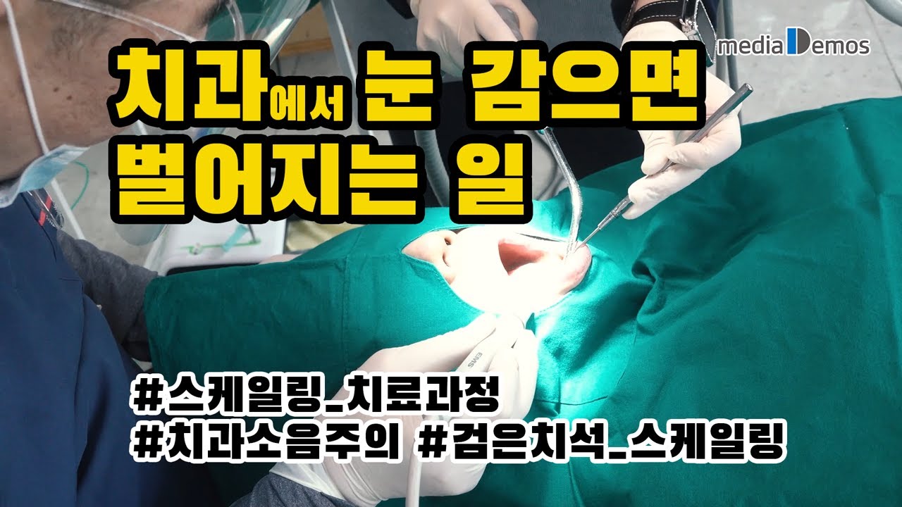 당신이 치과에서 눈 감으면 벌어지는 일 - 스케일링 치료과정 ///치과소음 주의/// 검은 치석 제거