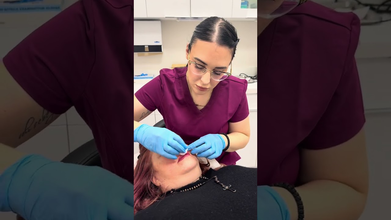 STYLAGE Dermal Fillers #shorts