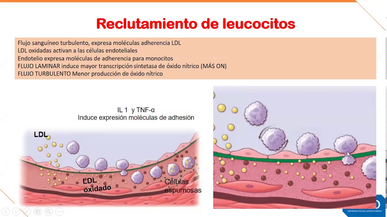 FISIOPATOLOGÍA - Semana 6 - Ateroesclerosis y Cardiopatía Isquémica
