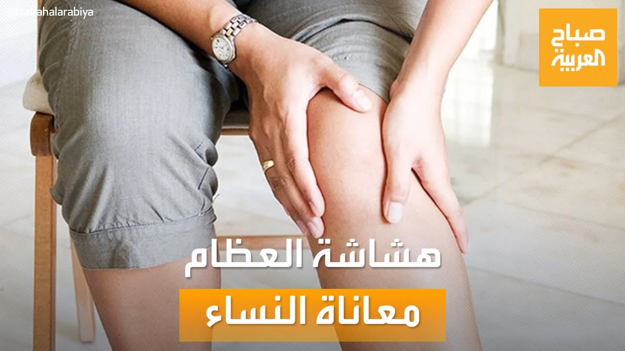 صباح العربية | هشاشة العظام.. من يُعاني منها أكثر الرجال أم النساء؟