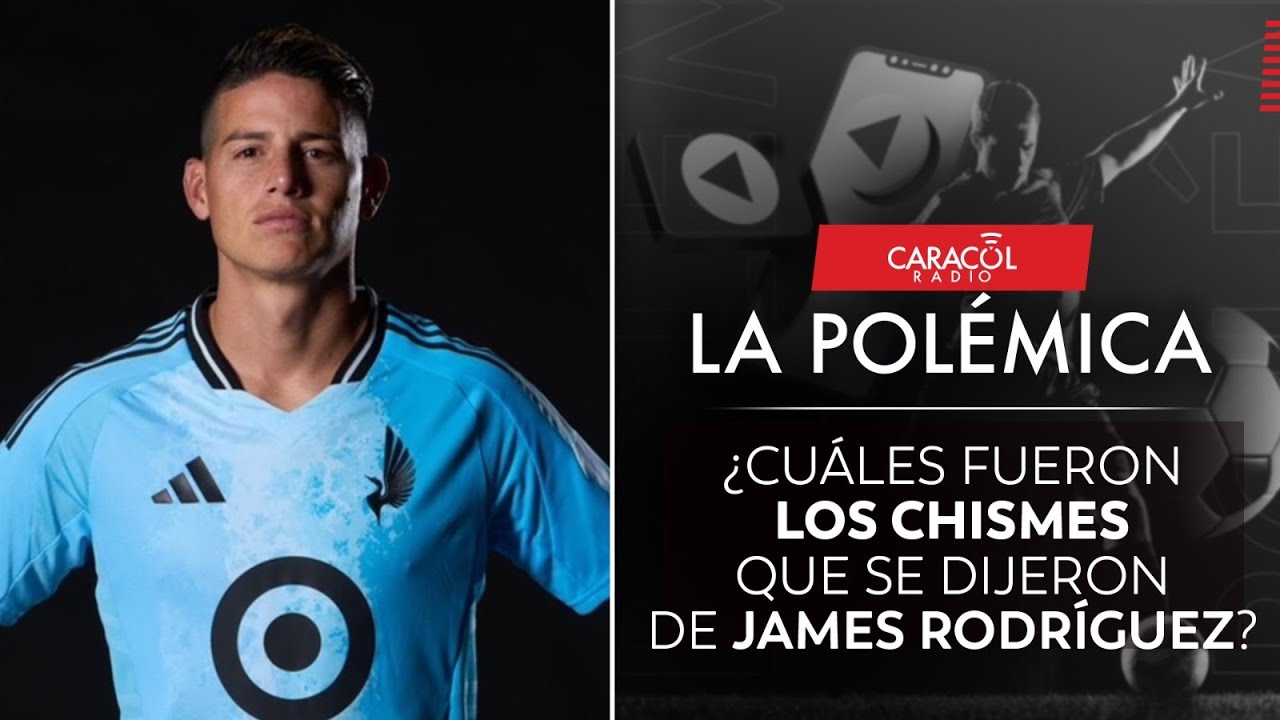 ¿Cuáles fueron los chismes que se dijeron de James Rodríguez? | Caracol Radio