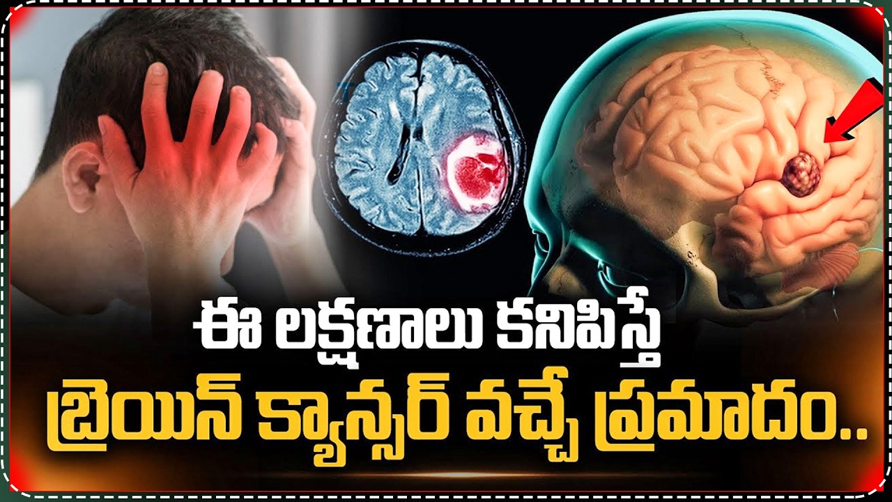 ఈ లక్షణాలు కనిపిస్తే బ్రెయిన్ క్యాన్సర్ వచ్చే ప్రమాదం..| Dr Satheesh Kathula Brain Cancer Symptoms