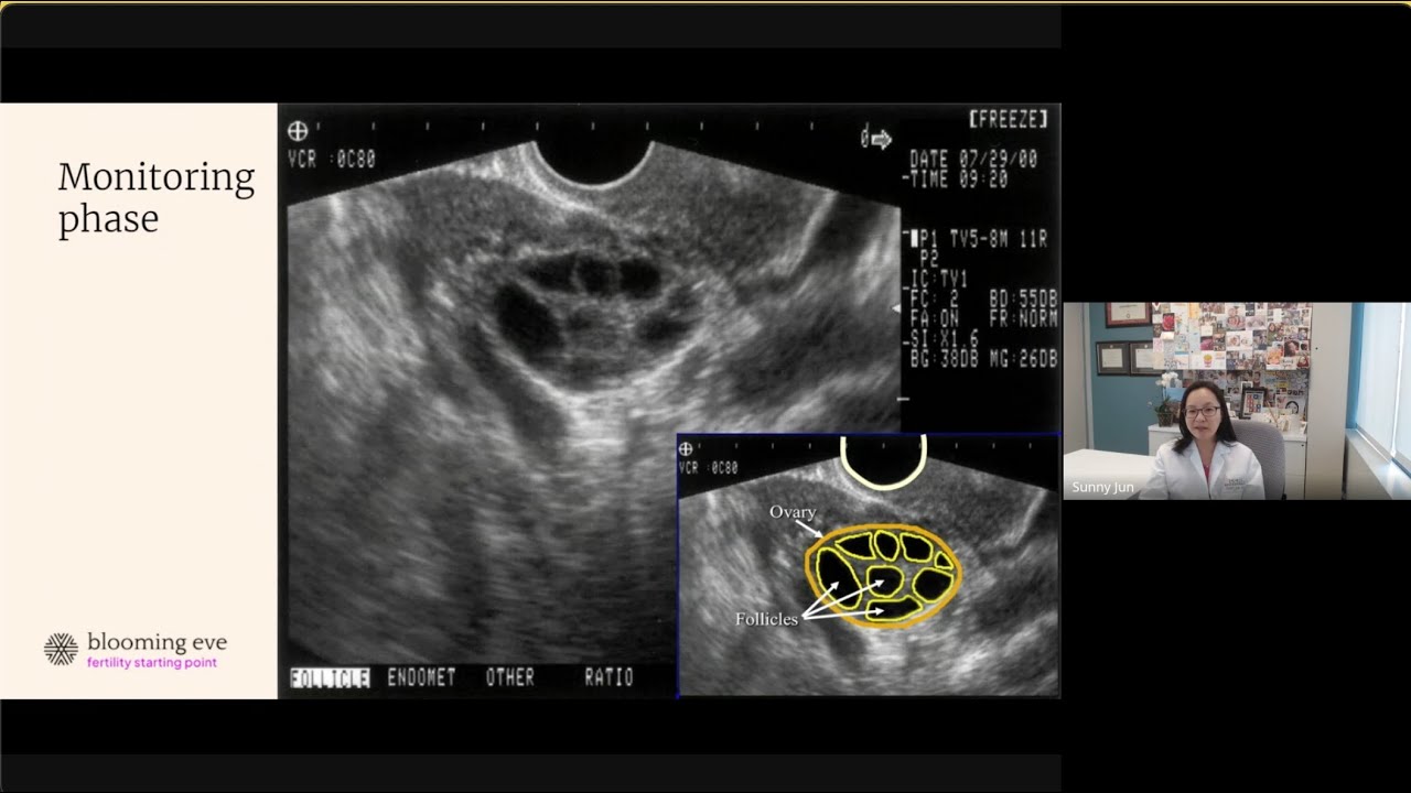 OBGYN&rsquo;s guide to IVF: process and technology