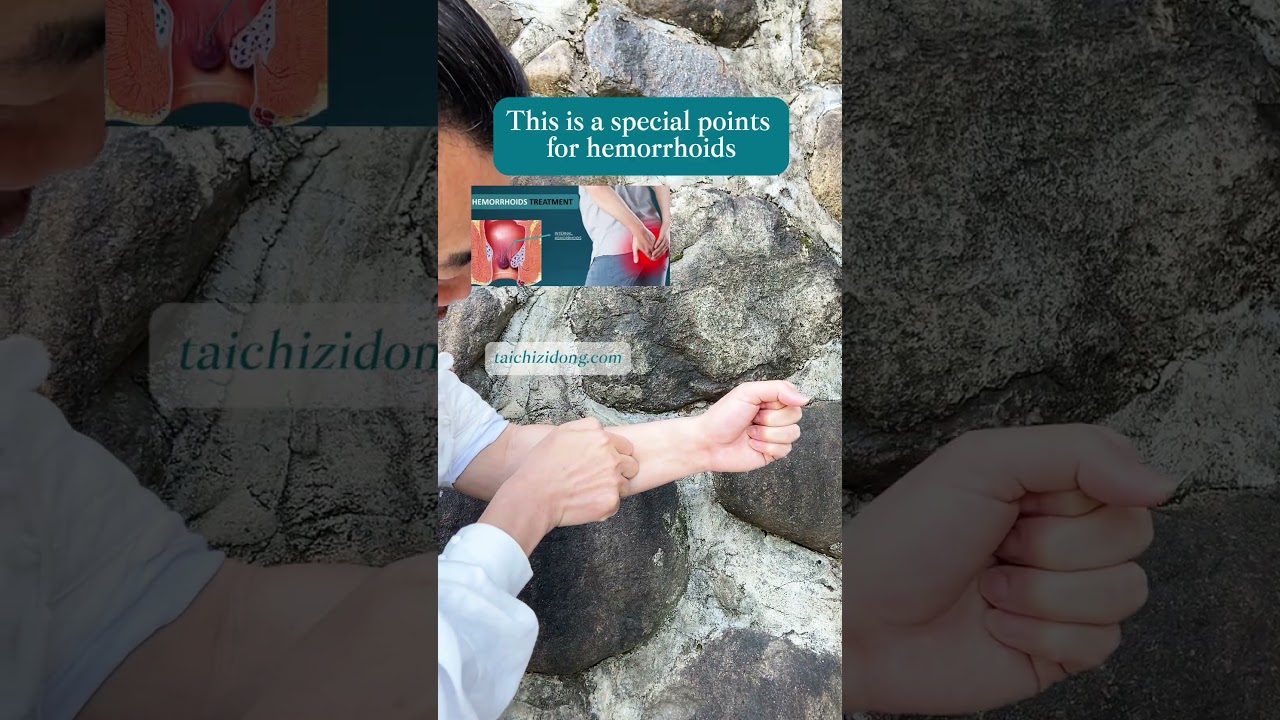 250472-Press Erbai points.