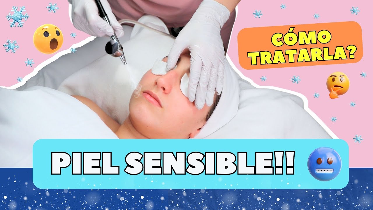 QUÉ ES LA ROSÁCEA? 😱✨❄️ Cómo tratarla! Protocolo completo!