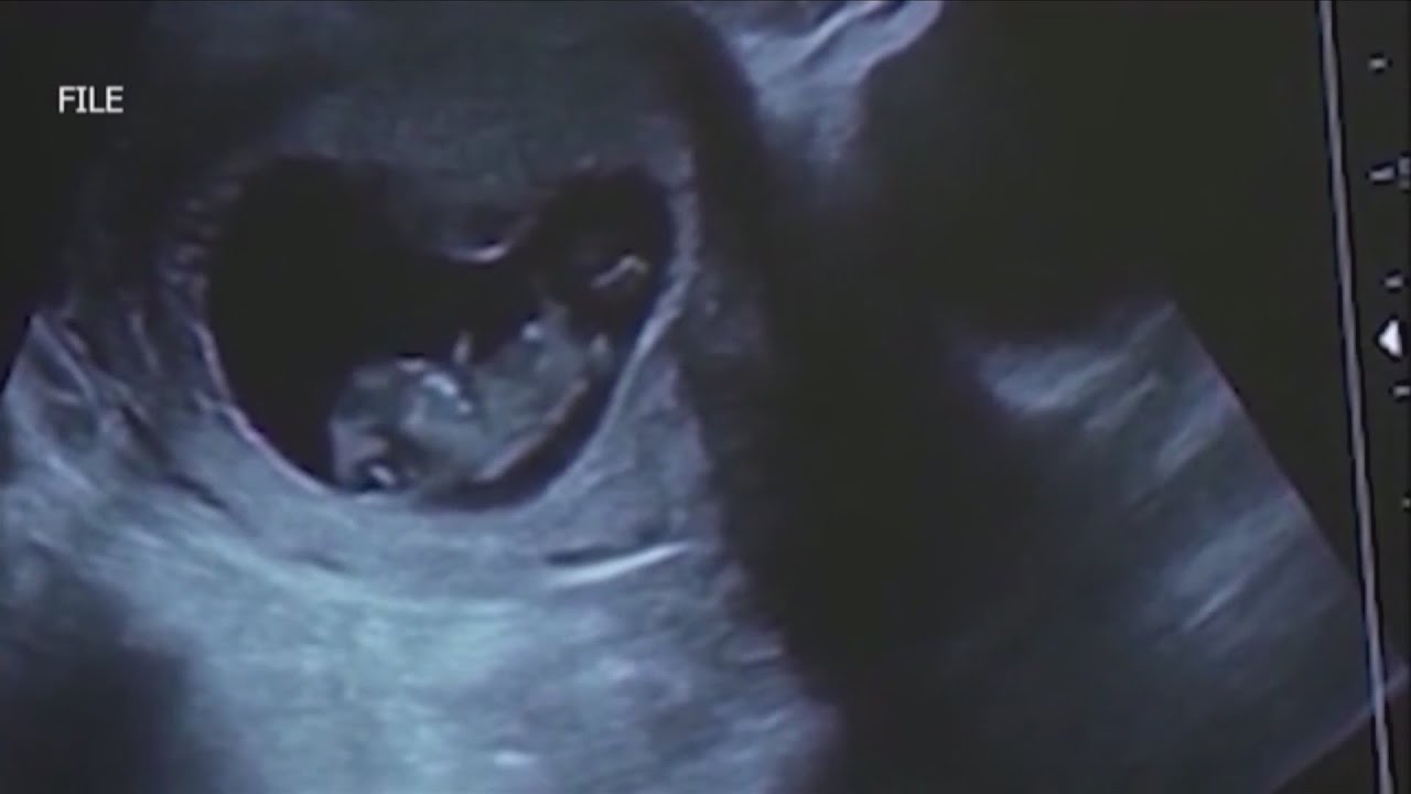 Reaction to Iowa 6-week abortion ban bill