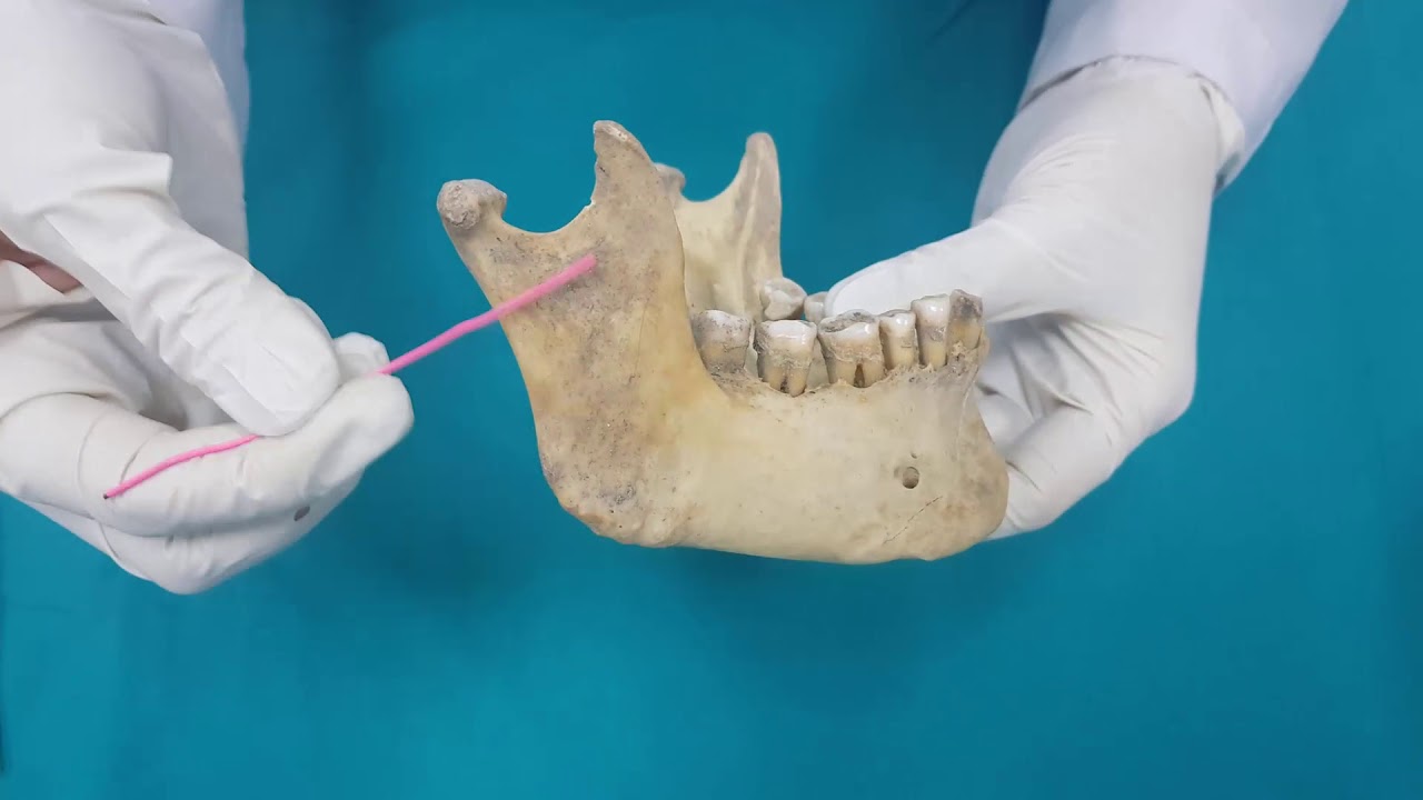 Anatomi Kemikler Ossa Cranii-Viscerocranium Kemikleri-Os Mandibula Anatomisi
