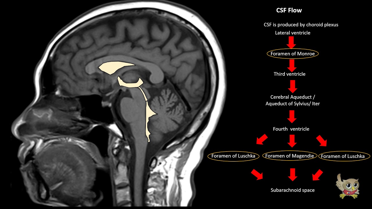 SYNAPSE 101 How to read a MRI Brain