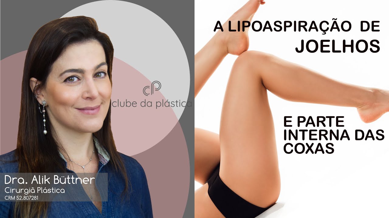 Clube da Plástica: A lipoaspiração dos joelhos e parte interna das coxas