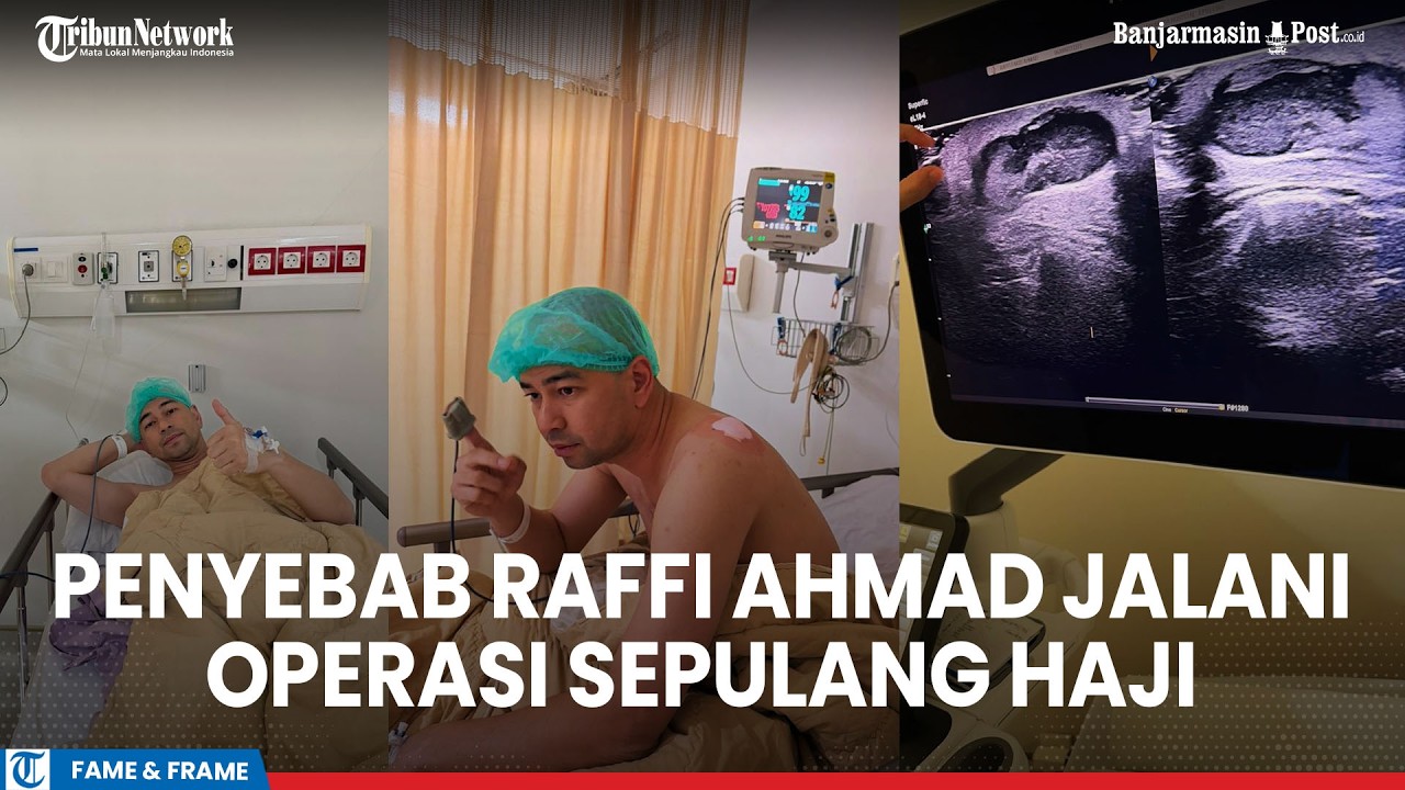 Penyebab Raffi Ahmad Jalani Operasi Medis Sepulang Haji Terungkap