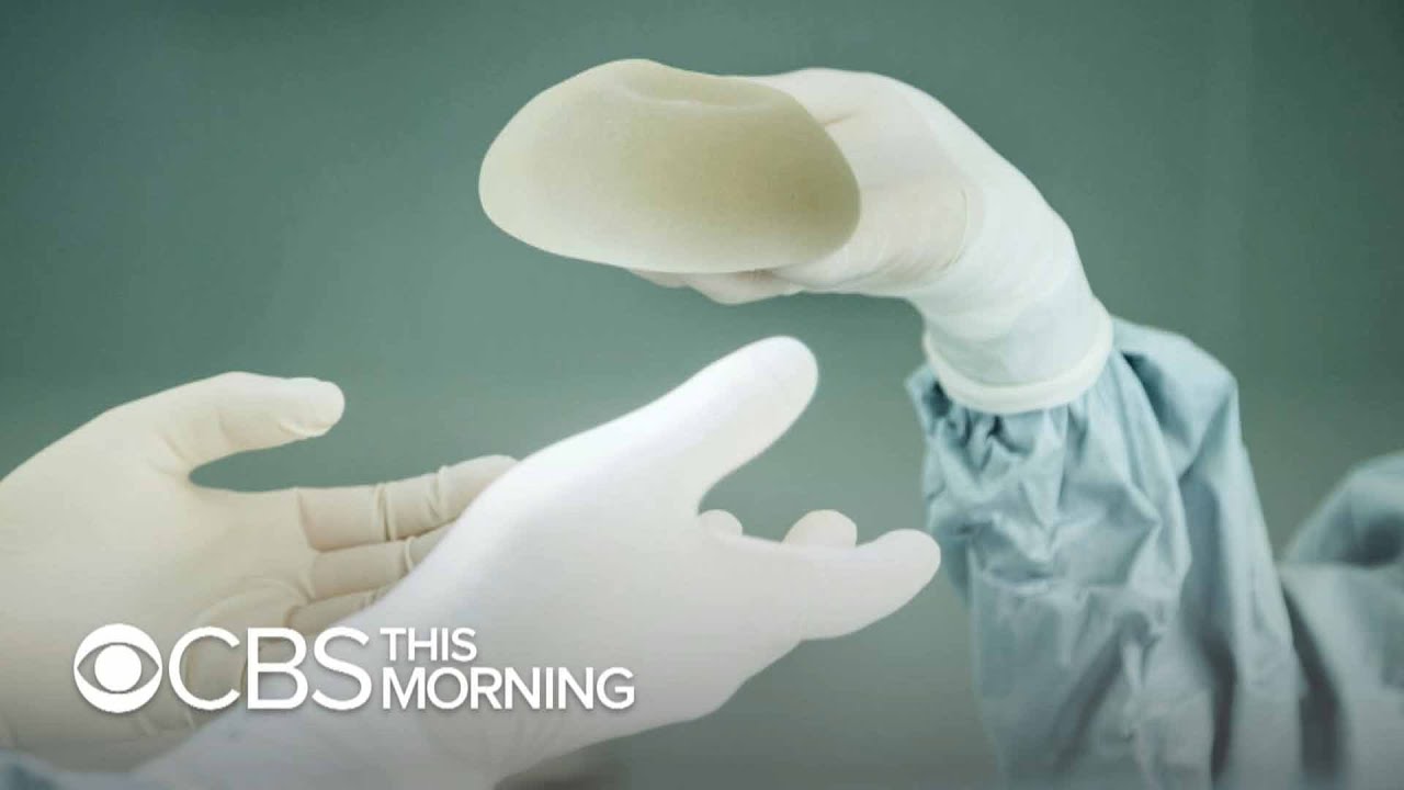 FDA weighs possible cancer risks of textured breast implants