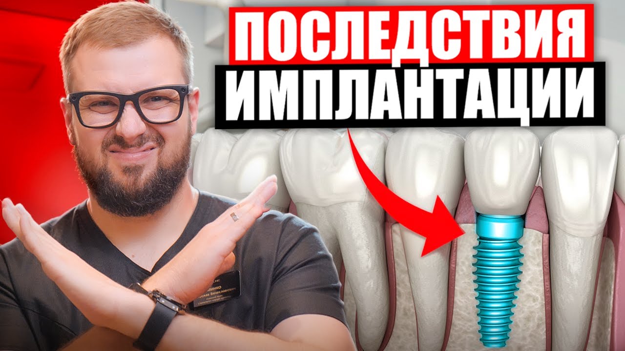 Не ставьте Имплант, пока не посмотрите это видео! Вся правда про импланты в 2026 году