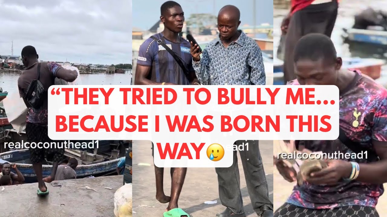 Born This Way, Still Hustling! Meet Jump Jump | Nigeria’s Inspiring Disabled Hustler 💪 #motivation