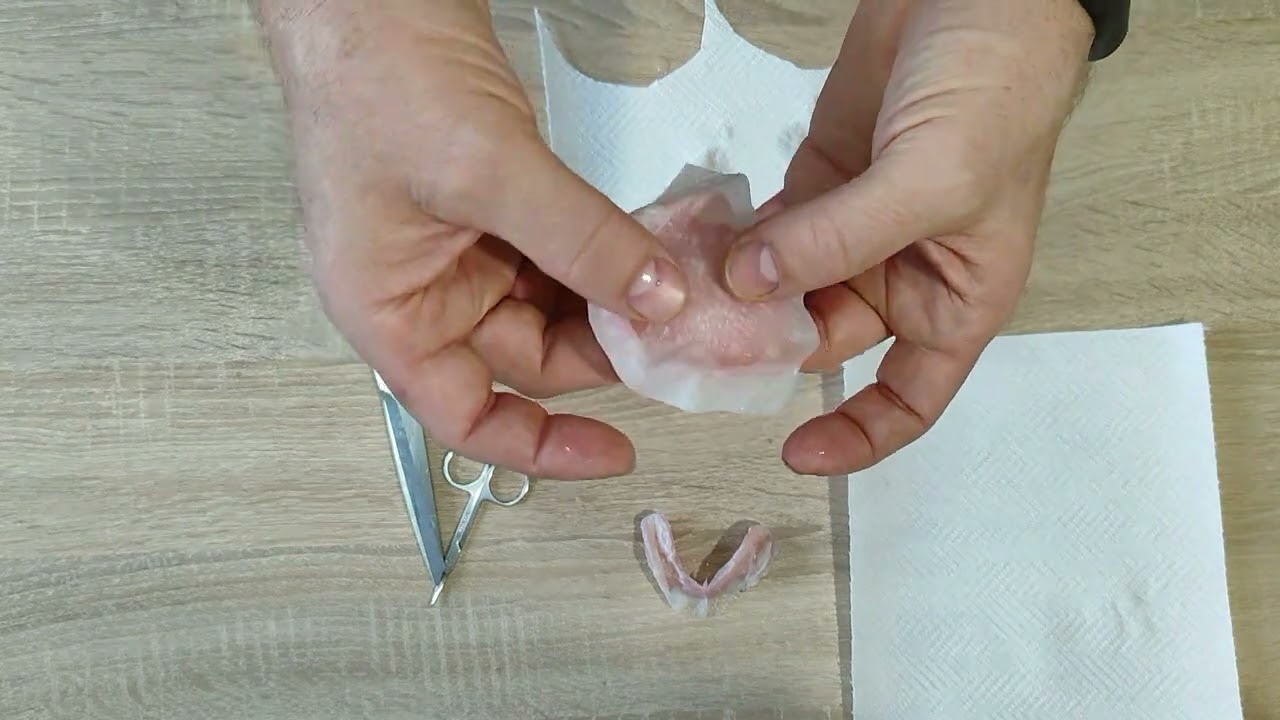 фиксация протеза