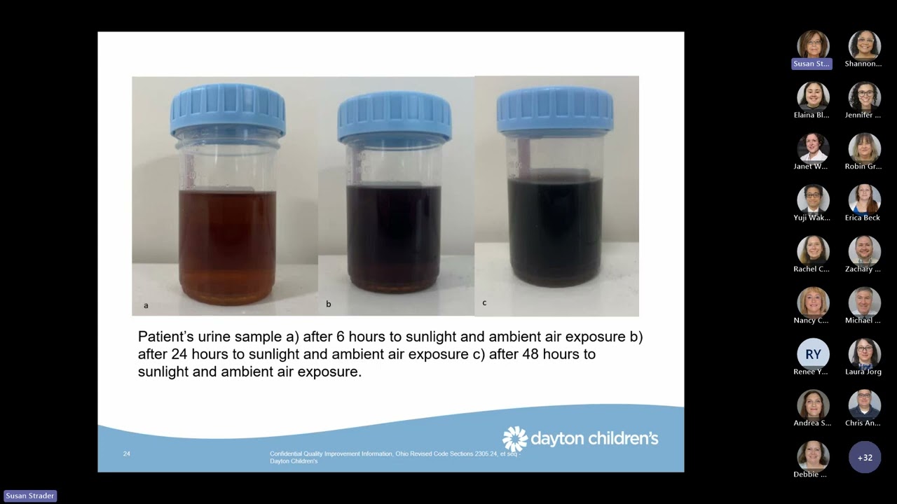 Grand Rounds - A Case of Refractory Hyponatremia
