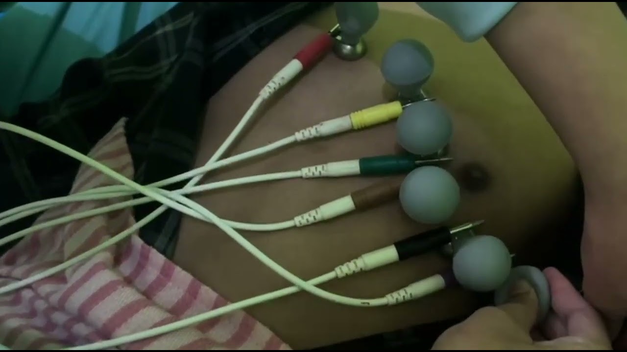 PEMERIKASAAN EKG (ELEKTROKARDIOGRAM)