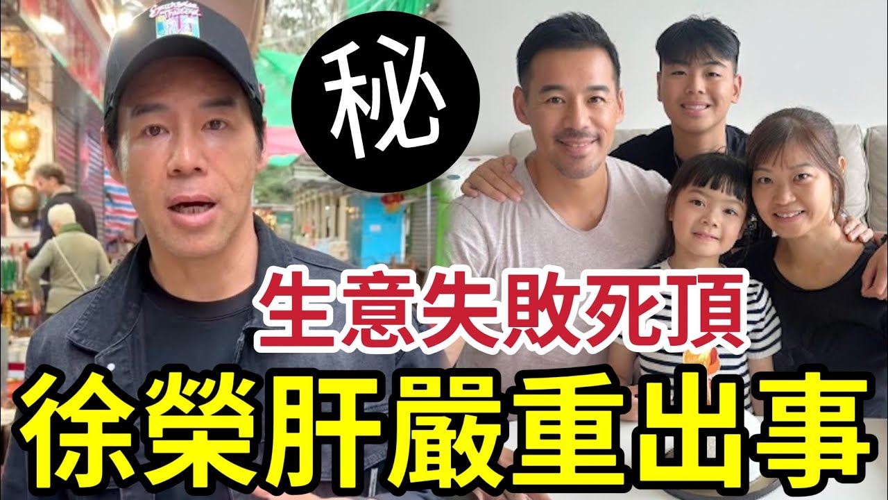 TVB徐榮肝藏出事！唔肥有做運動「都有嚴重問題」老板夢！補習社生意失敗「死頂火鍋店」連人工都出唔到！仲捱身體.... #愛回家