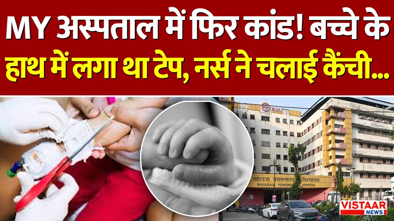 MY Hospital Indore: MY अस्पताल में फिर कांड! बच्चे के हाथ में लगा था टेप, नर्स ने चलाई कैंची...