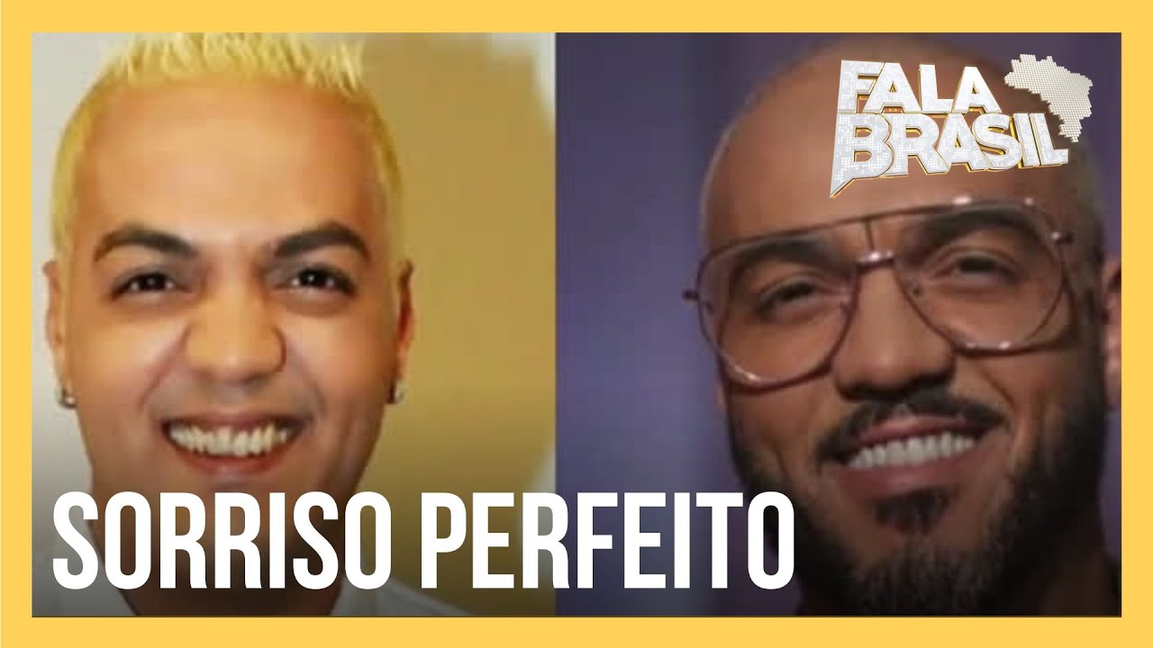 Confira os prós e contras de usar lente de contato dental, querida pelos famosos