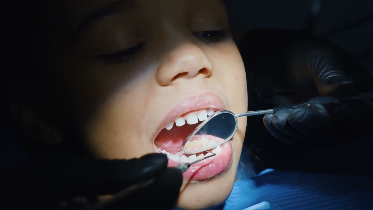 Quando e come curare i denti dei bambini