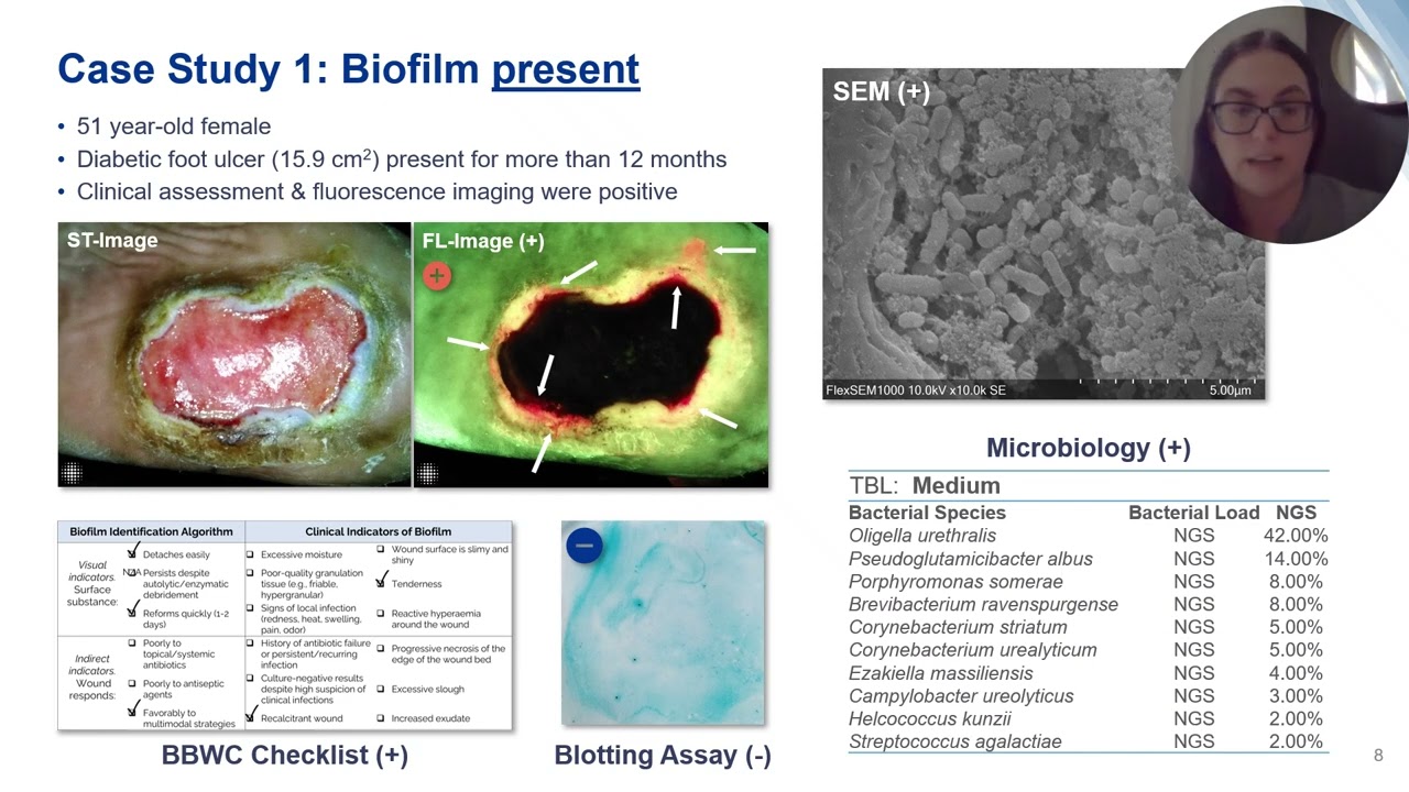 Assessing Biofilm at the Bedside:Exploring Reliable Accessible Biofilm Detection Methods