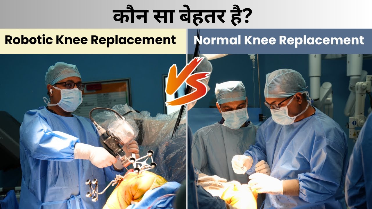Normal or Robotic Knee Replacement Surgery   – कौन सा बेहतर? || Robotic Knee Replacement Surgery