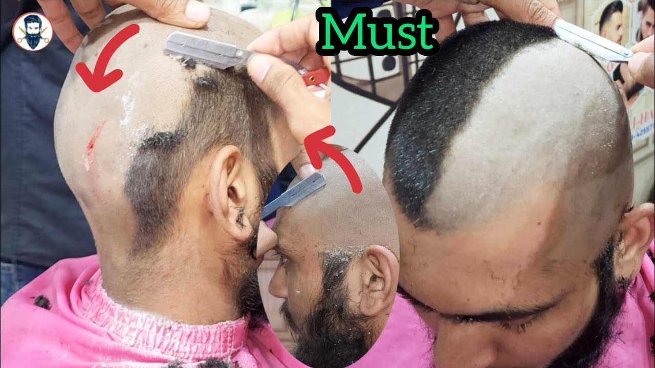 Dandruff Shave 🥺How to Must Attractive Dandruff Remove Solution Head Shaver ❓