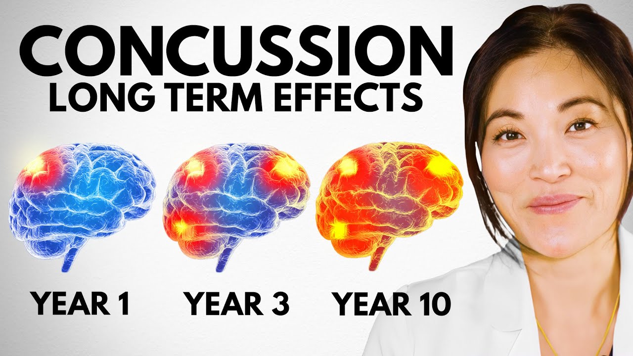 The Truth About Multiple Concussions... Long Term Damage & Recovery